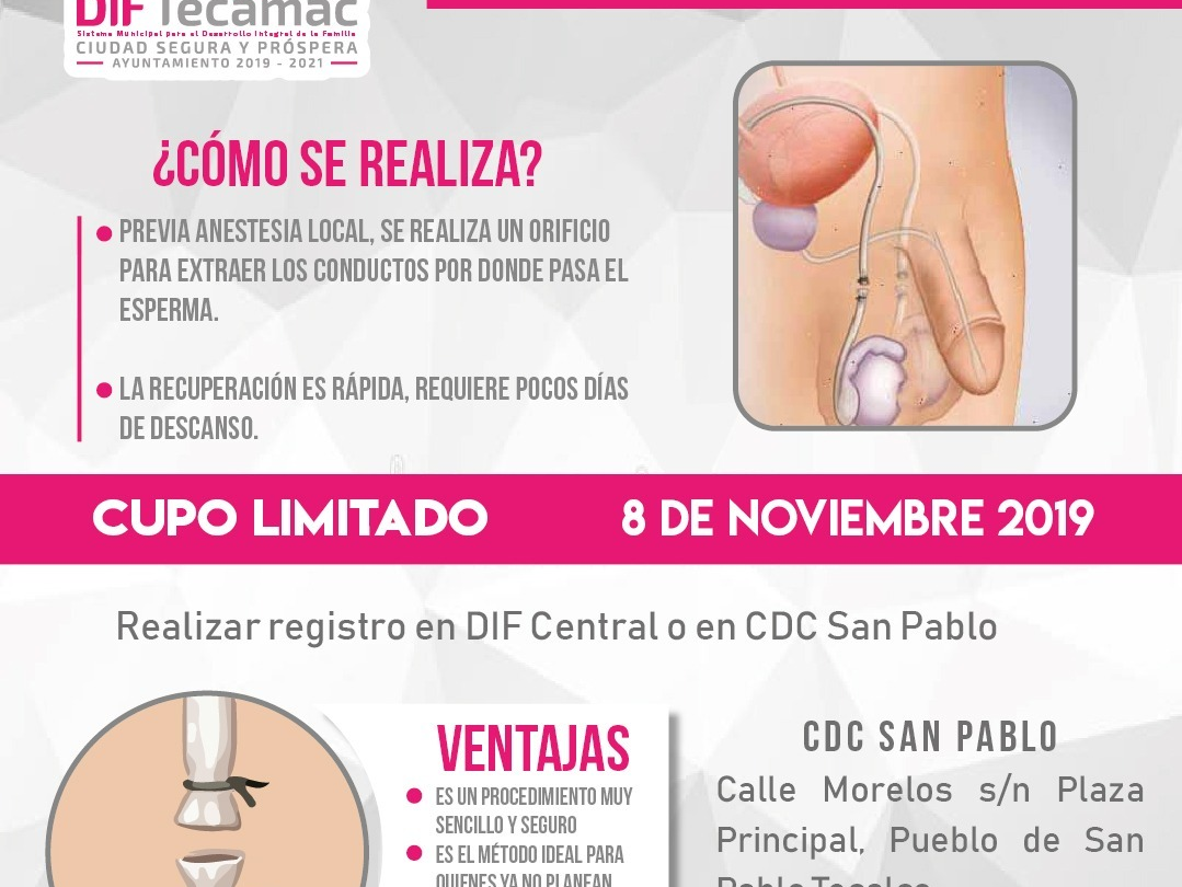vasectomia sin bisturi en el DIF de Tecamac | México Ahora vasectomia sin bisturi en el DIF de Tecamac