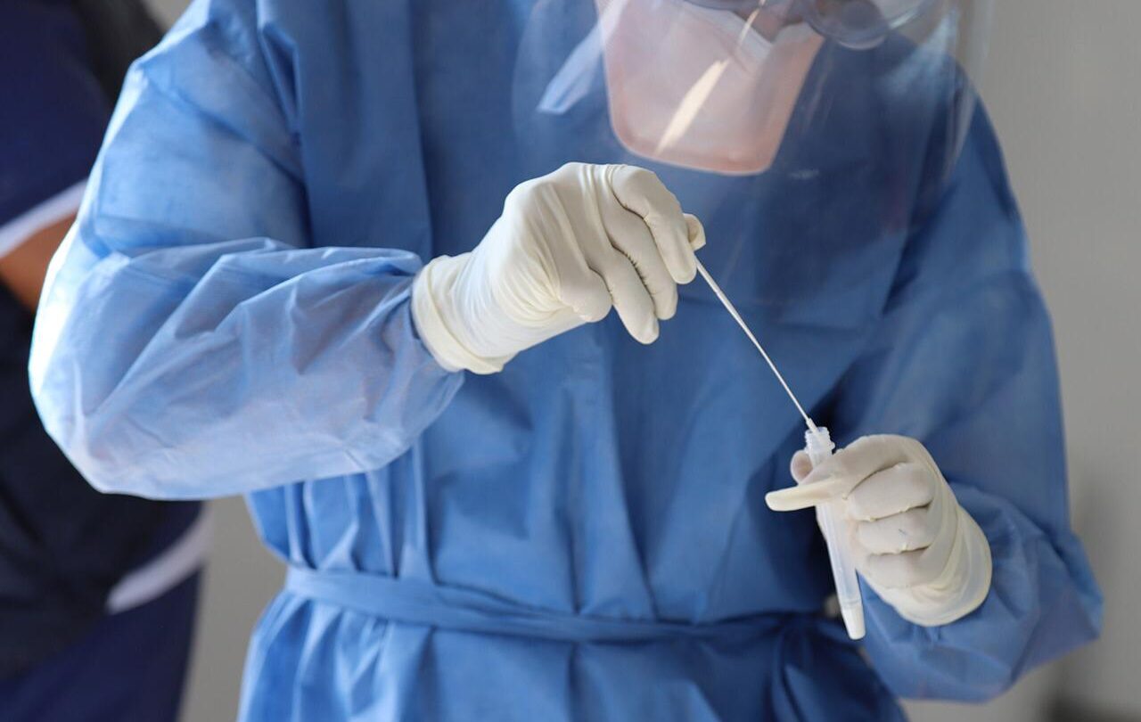 autorizan que laboratorio del issemym realice pruebas pcr a sospechosos de covid 19 Autorizan que laboratorio del ISSEMYM realice pruebas PCR a sospechosos de COVID 19 |