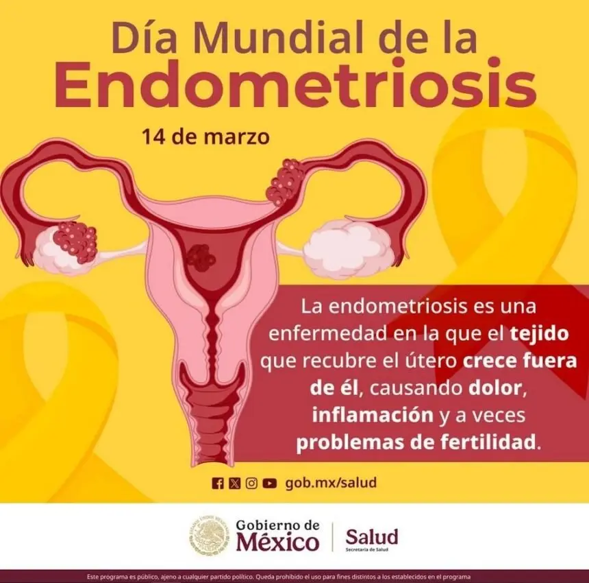 se-suma-sesa-a-la-conmemoracion-del-dia-mundial-de-la-endometriosis | México Ahora Se suma SESA a la conmemoración del Día Mundial de la