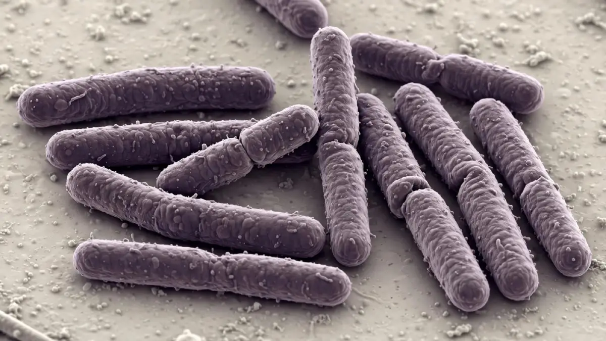 Bacteria carnívora Vibrio vulnificus deja primera muerte 2026 Florida Bacteria carnívora Vibrio vulnificus deja primera muerte de 2026 en Florida | Bacteria carnívora Vibrio vulnificus deja primera muerte de 2026 en Florida
