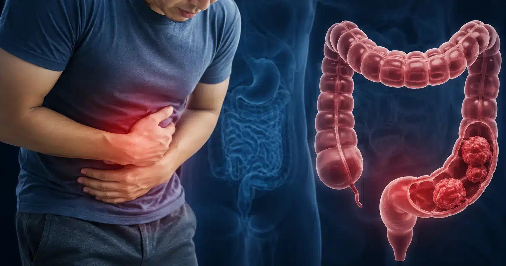MA2026cancerjovenes Cáncer de colon aumenta en México y afecta cada vez a personas más jóvenes | 15 mil nuevos casos al año cáncer colorrectal se dispara en México