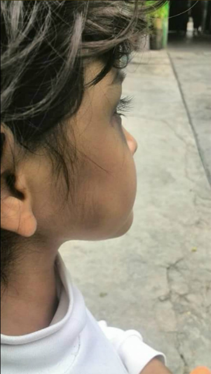 Niña de 4 años fue golpeada por su padrastro. No hay nada más triste que escucharla contarlo todo