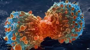 Descubren que la primera persona que tuvo cáncer fue hace 1.7 millones de años y fue ¡un niño!