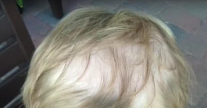 Mamá envió a su hijo a la escuela como cada día. Entonces el profesor nota esto entre su cabello