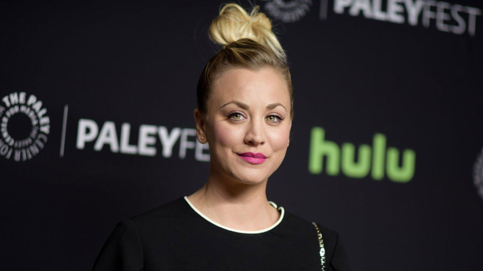 Kaley Cuoco reveló todas las cirugías estéticas a las que se sometió