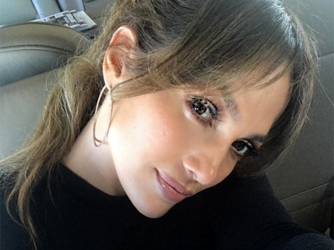 Jennifer Lopez presume su ojo morado en Instagram