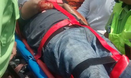 Asaltantes balean a empleado y herido logra llegar a su trabajo en Naucalpan