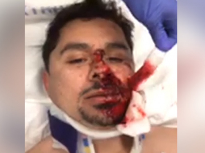 ¡Sin dientes! Quedó Larry Hernández tras caer de su ‘bici’