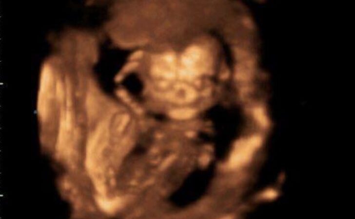 11 ecografías de bebés “poco agraciados” que te harán perder las ganas de tener un hijo en segundos