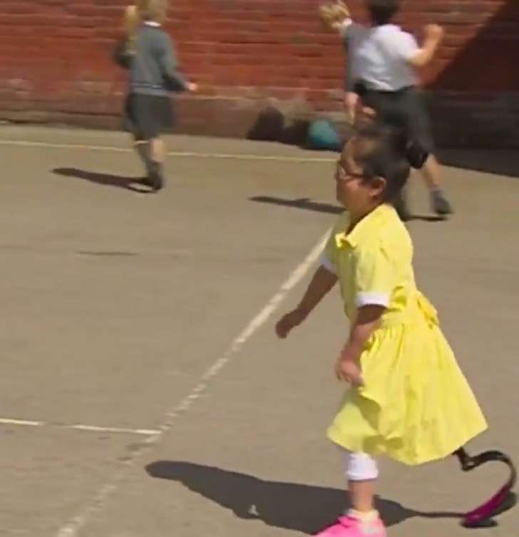 Llegó a la escuela con prótesis nueva. Cuando sus amigos la ven ella no puede aguantar las lágrimas