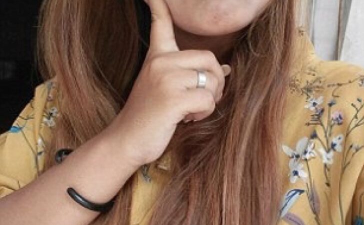 Un error la dejó con cejas “pintadas con marcador”. Deberá hacerse tratamiento láser por 6 meses