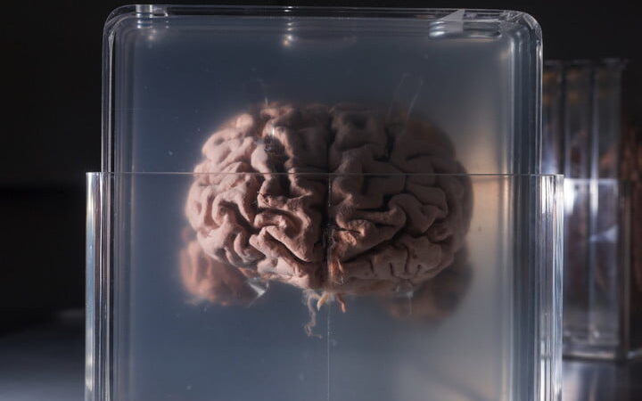 Empresa vende la “Inmortalidad” haciendo copias de los cerebros