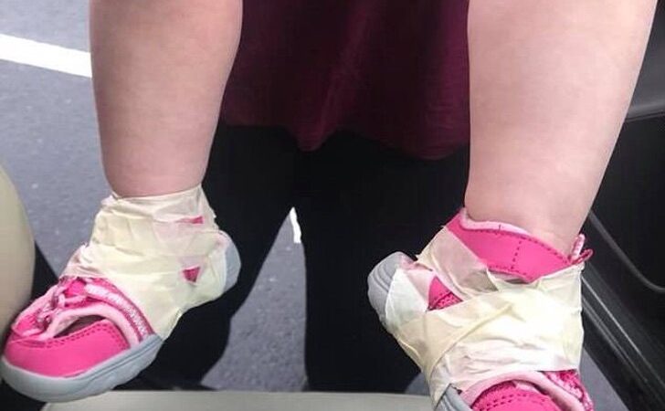 Estaban hartos de que la bebé se quitara los zapatos. Tomaron una cinta y los aseguraron a su piel