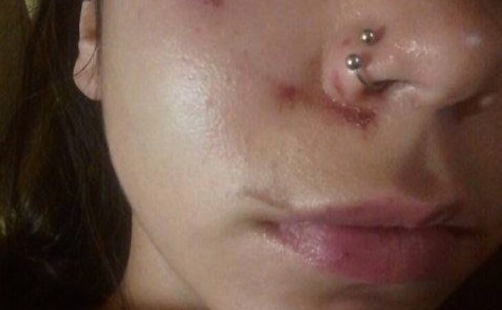 Mujer fue golpeada y azotada tras oponer resistencia ante un extraño que intentó besarla y tocarla