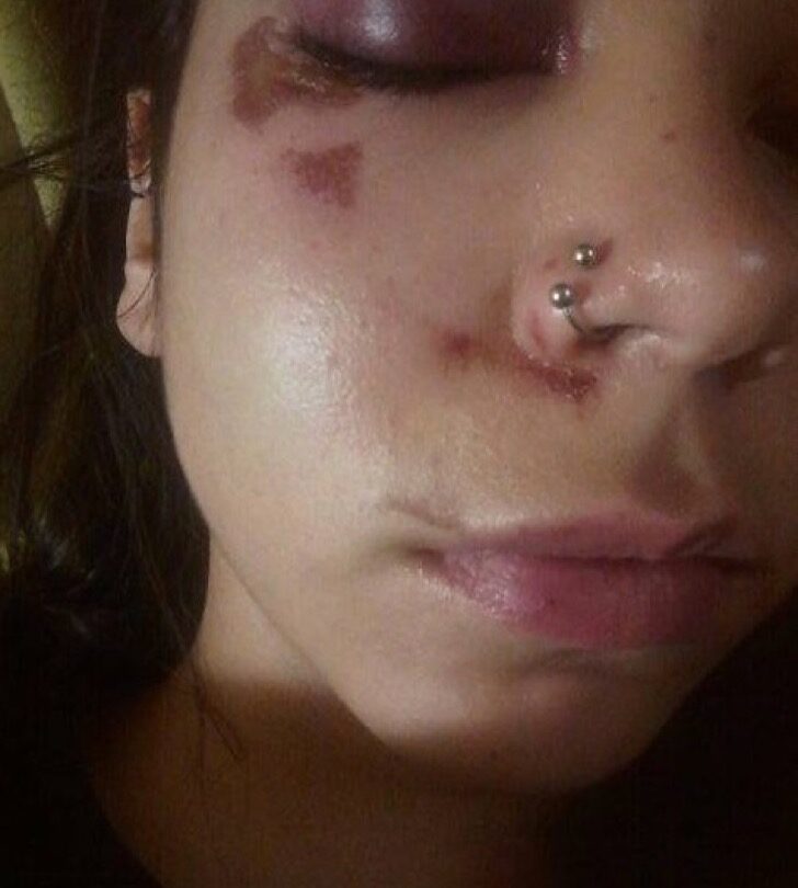 Mujer fue golpeada y azotada tras oponer resistencia ante un extraño que intentó besarla y tocarla |