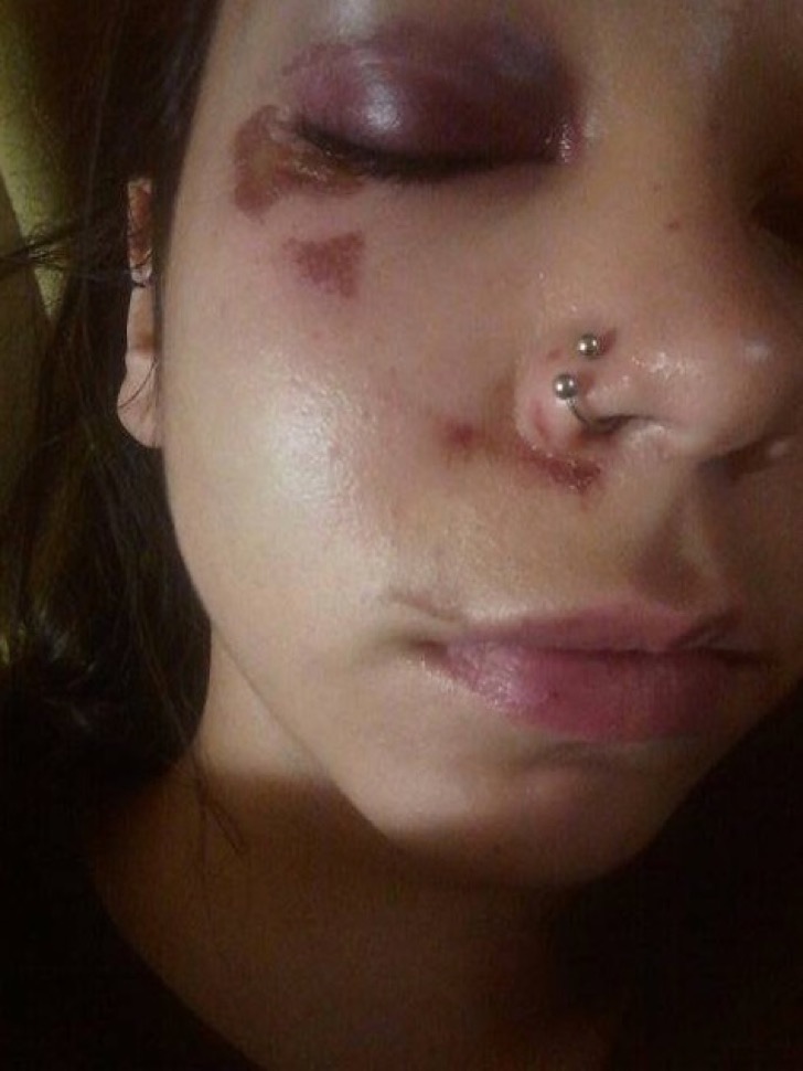 Mujer fue golpeada y azotada tras oponer resistencia ante un extraño que intentó besarla y tocarla