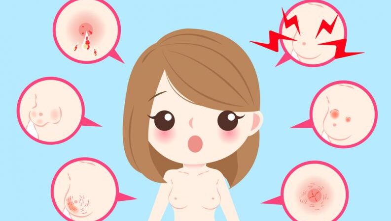 Señales de cáncer de mama (que no son sentir un bulto) a las que debes prestar atención