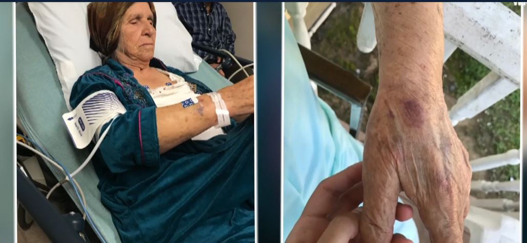 Policía disparo con pistola eléctrica a mujer de 87 años que cortaba flores con un cuchillo