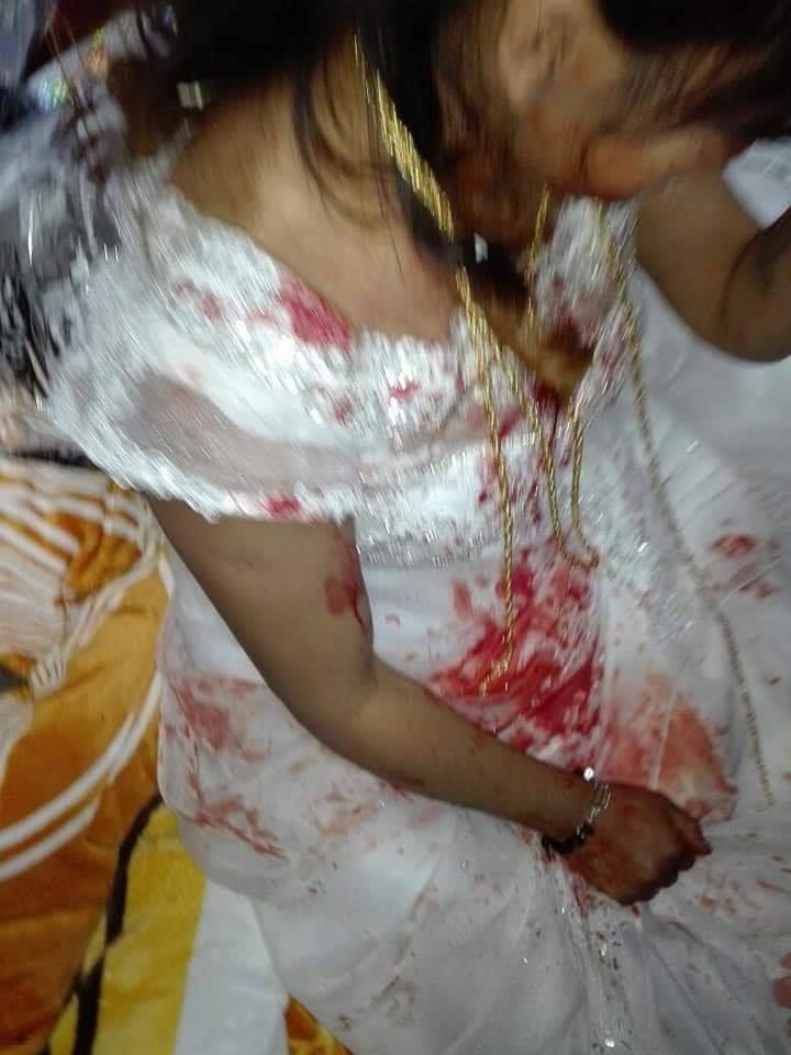 Golpeo a su esposa el día de su Boda y tiño de sangre su vestido