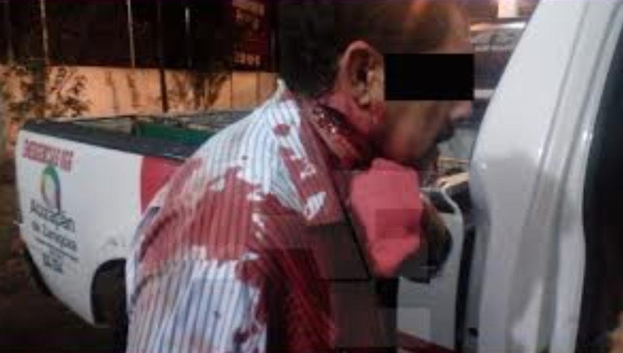 Navajean a taxista; por 2,500 pesos casi pierde la vida en Naucalpan