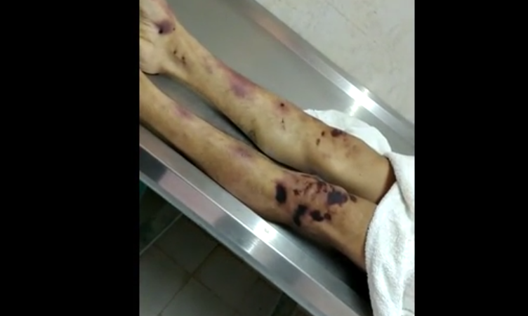 Causa terror cadáver de reo asesinado en penal de Chiconautla