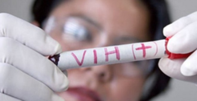 Descubren fármaco que elimina células con VIH del cuerpo