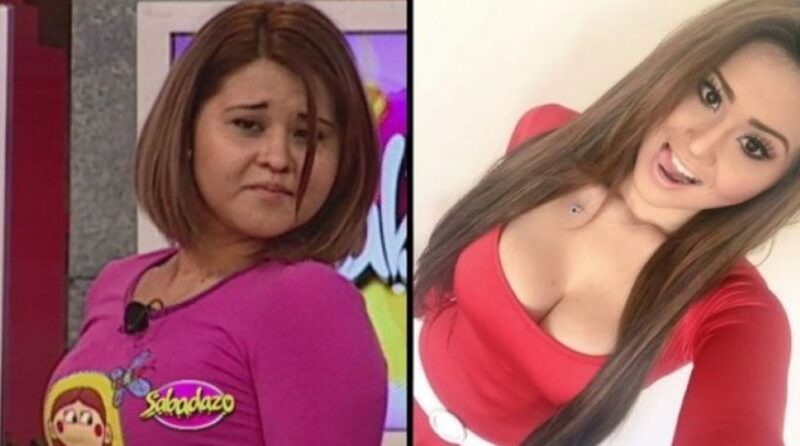 Estas son todas las cirugías que se ha hecho Gomita ¡No lo creerás!