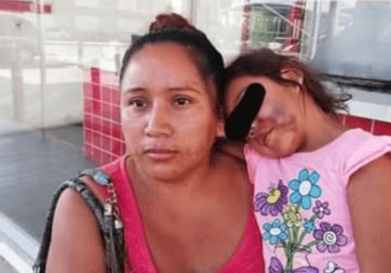 Niña es golpeada en kinder de Tamaulipas, maestras aseguran que choco con otro niño