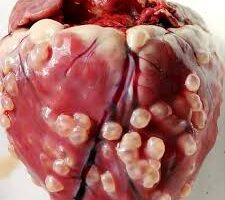 La UNAM busca eliminar la cisticercosis de México