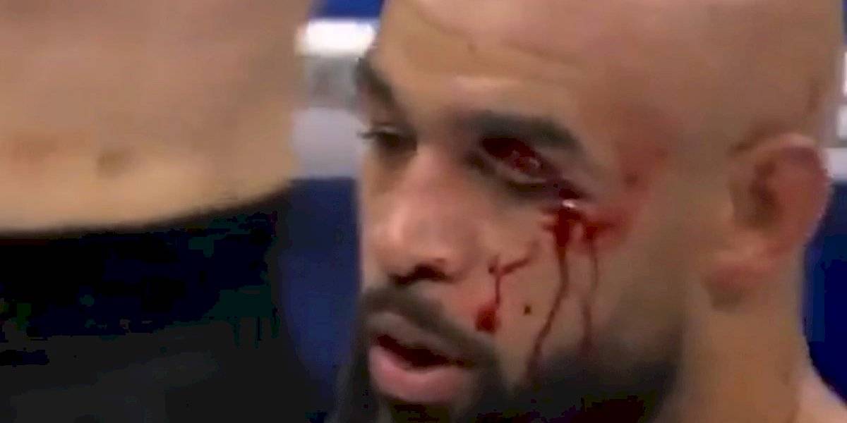 VIDEO | El escalofriante corte que sufrió un peleador de MMA