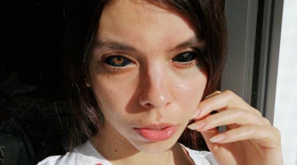 Aleksandra Sadowska queda ciega tras tatuarse los ojos, queria ser muy famosa