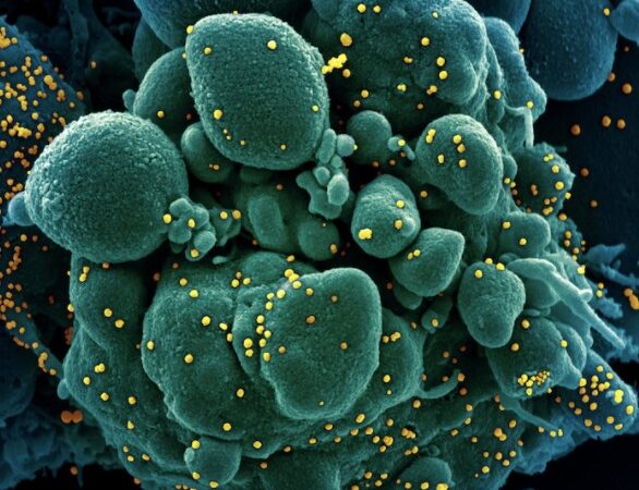 Es captado en fotos cómo el coronavirus ataca a las células humanas