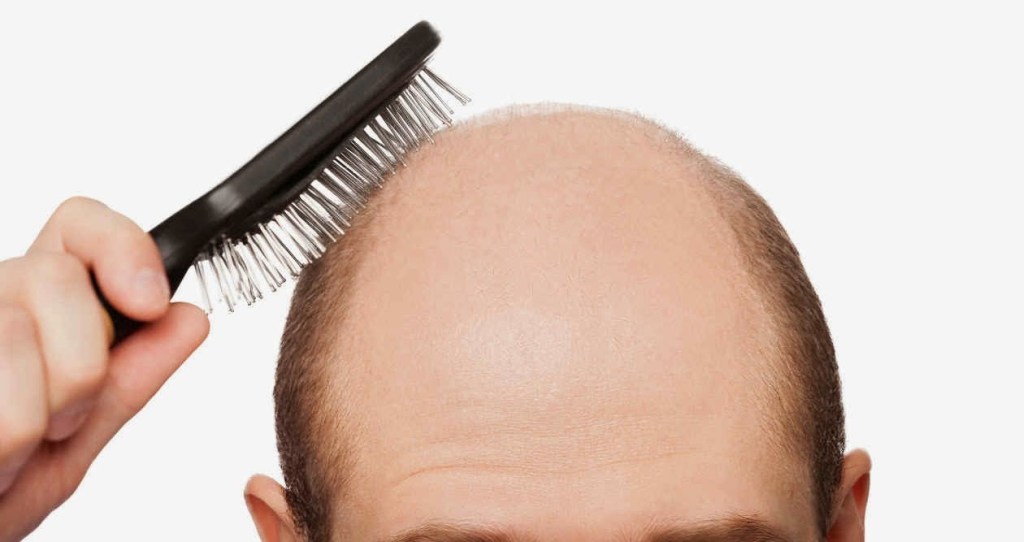 Dale una excelente solución a la pérdida de cabello