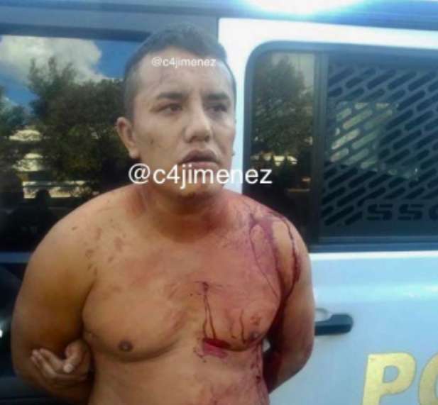 Ciudadanos-detienen-a-ladrón-y-se-les-escapa-a-policías-de-un-hospital-2