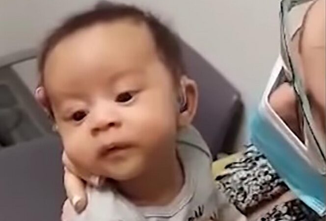 Pequeña Bebé Sorda Escucha Por Primera Vez La Voz De Su Mamá