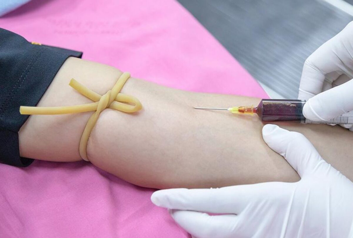 Qué es la anemia y cómo revertirla |