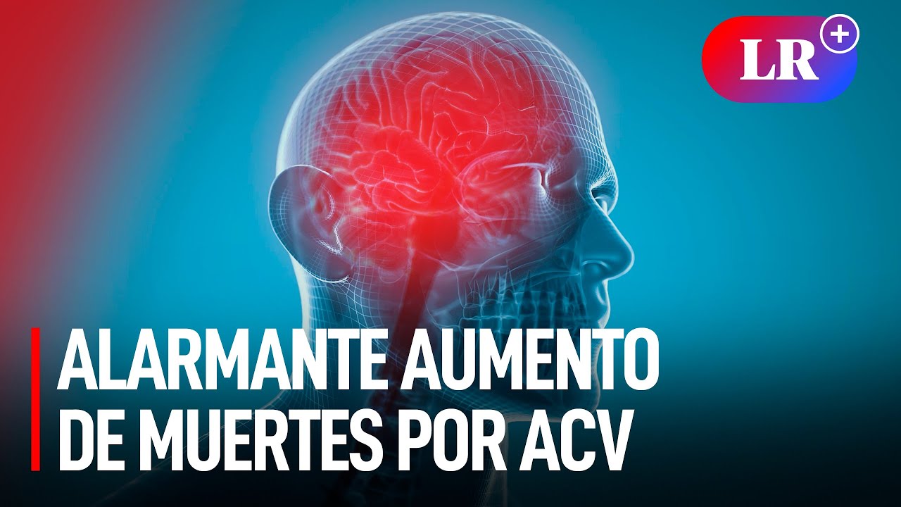 El alarmante aumento de muertes por accidente cerebrovascular: un llamado urgente a la acción