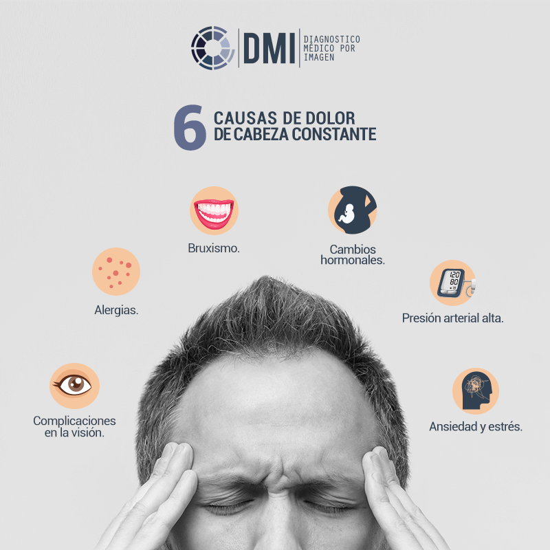 Seis causas frecuentes de un dolor de cabeza que quizás desconocías