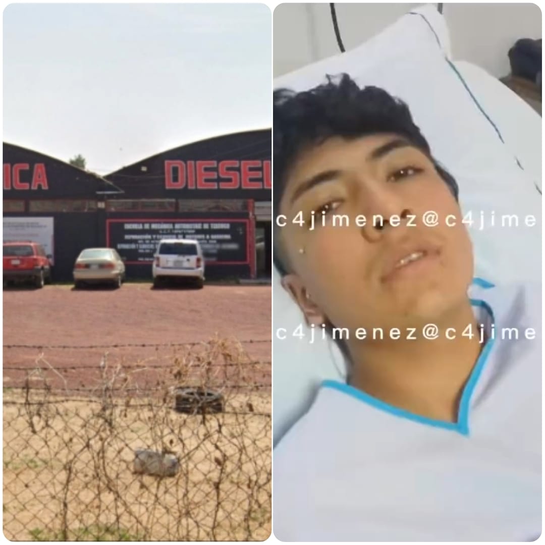 Compañeros rocían con gasolina y prenden fuego a joven, en Texcoco, Estado de México