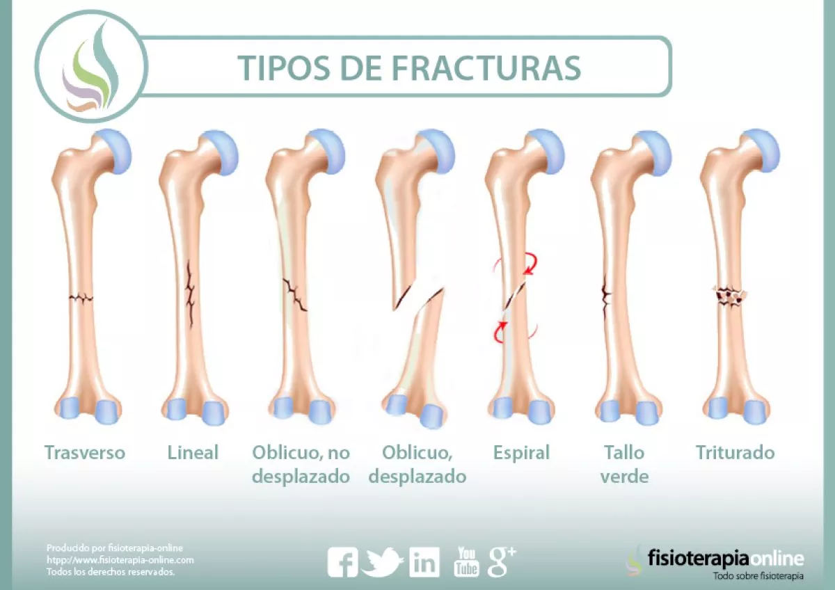 Fractura o ¿división de tareas?…