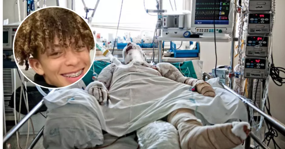 joven-se-suma-a-peligroso-reto-viral-y-termina-quemada-en-estados-unidos