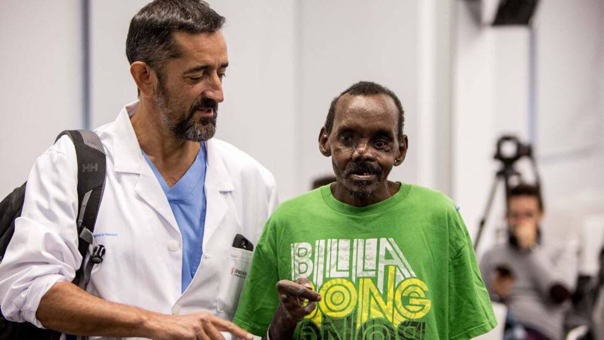 Reconstruye rostro de un hombre atacado por hiena