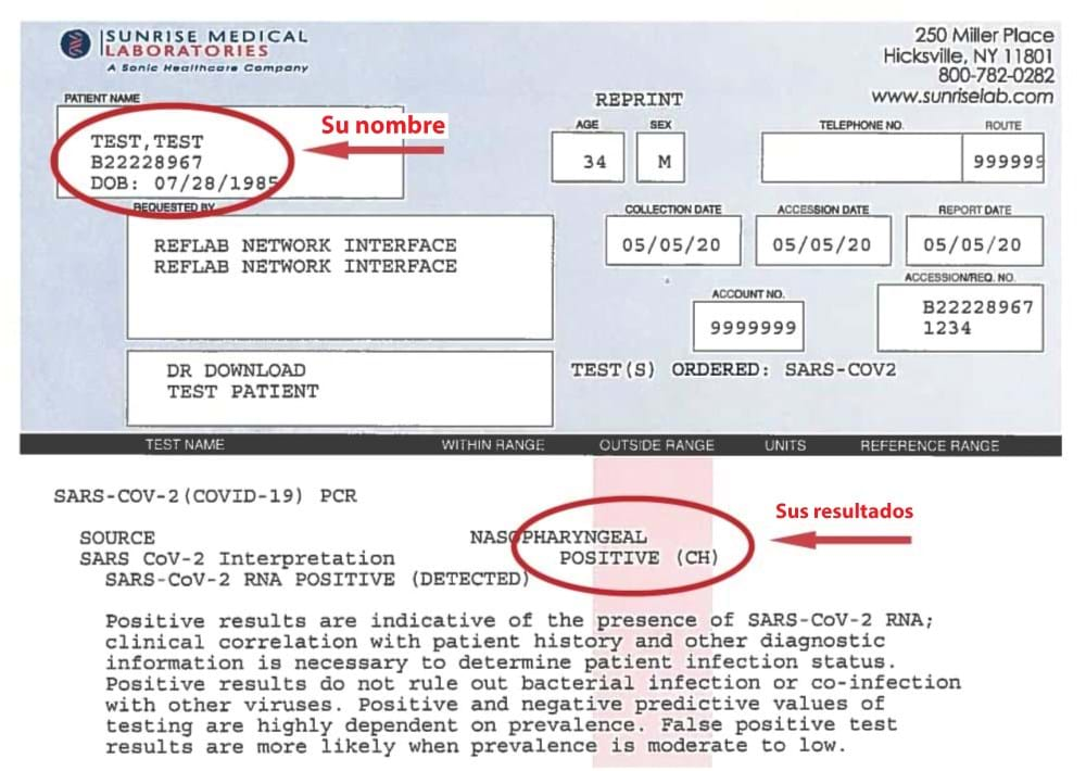 Da negativo Kuri a prueba PCR