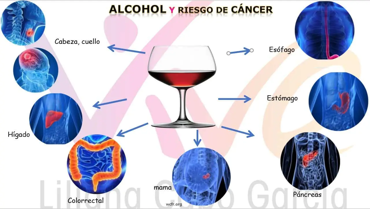 Alcohol  y cáncer |
