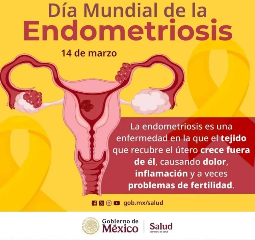 Se suma SESA a la conmemoración del Día Mundial de la Endometriosis