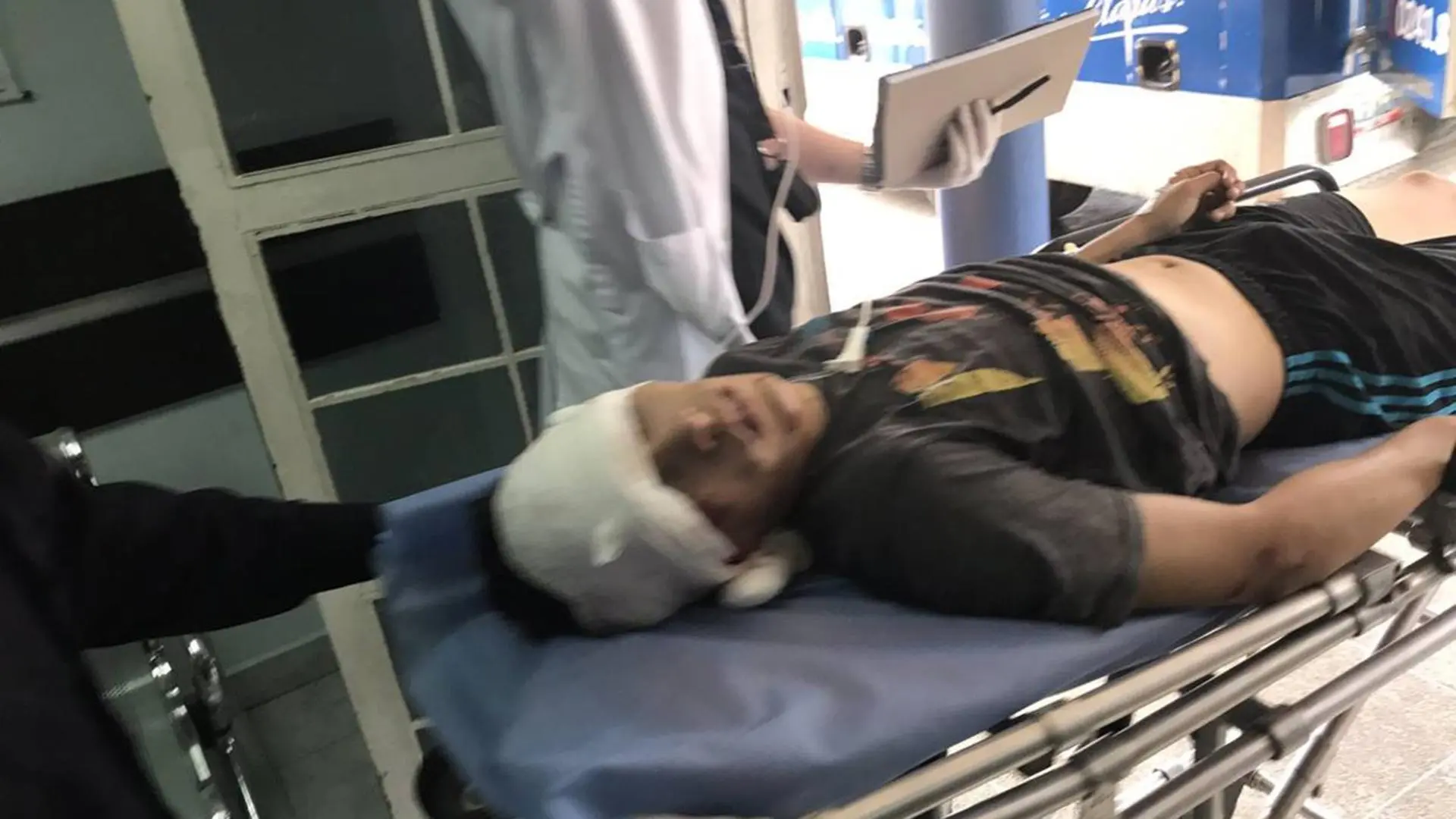 Un joven fue herido de bala en la cabeza por la represión chavista