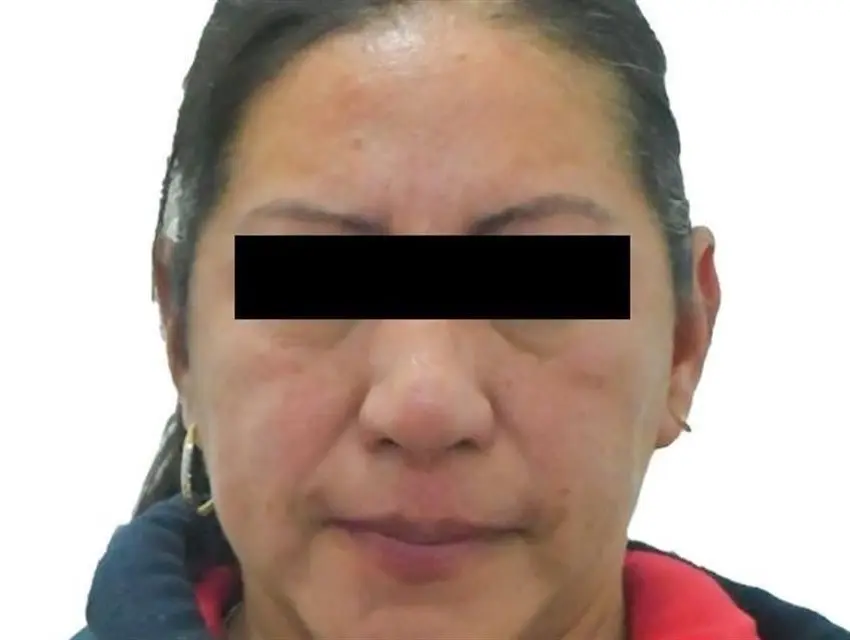 Alcaldesa de Capulhuac acusada de lesiones y abuso de autoridad