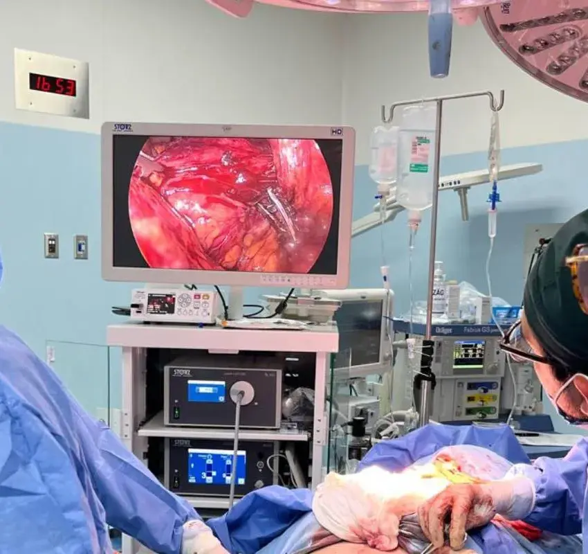 Se realiza primer reemplazo total de esófago en el Hospital IMSS Bienestar de Cuajimalpa