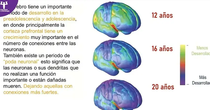 Analizaron impacto del sobrepeso en el cerebro infantil