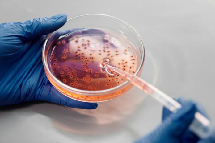 La amenaza creciente de la bacteria “come carne” - INFOPODER